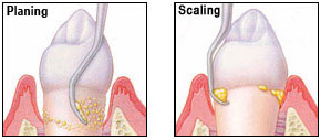 Planing and Scaling